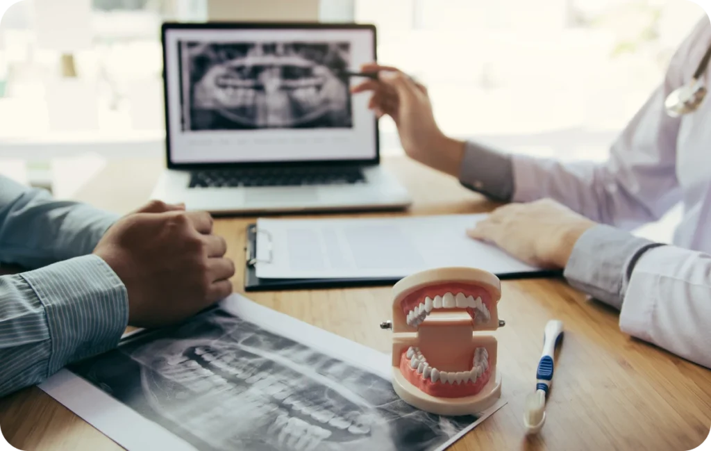 Rehabilitation complete par implants