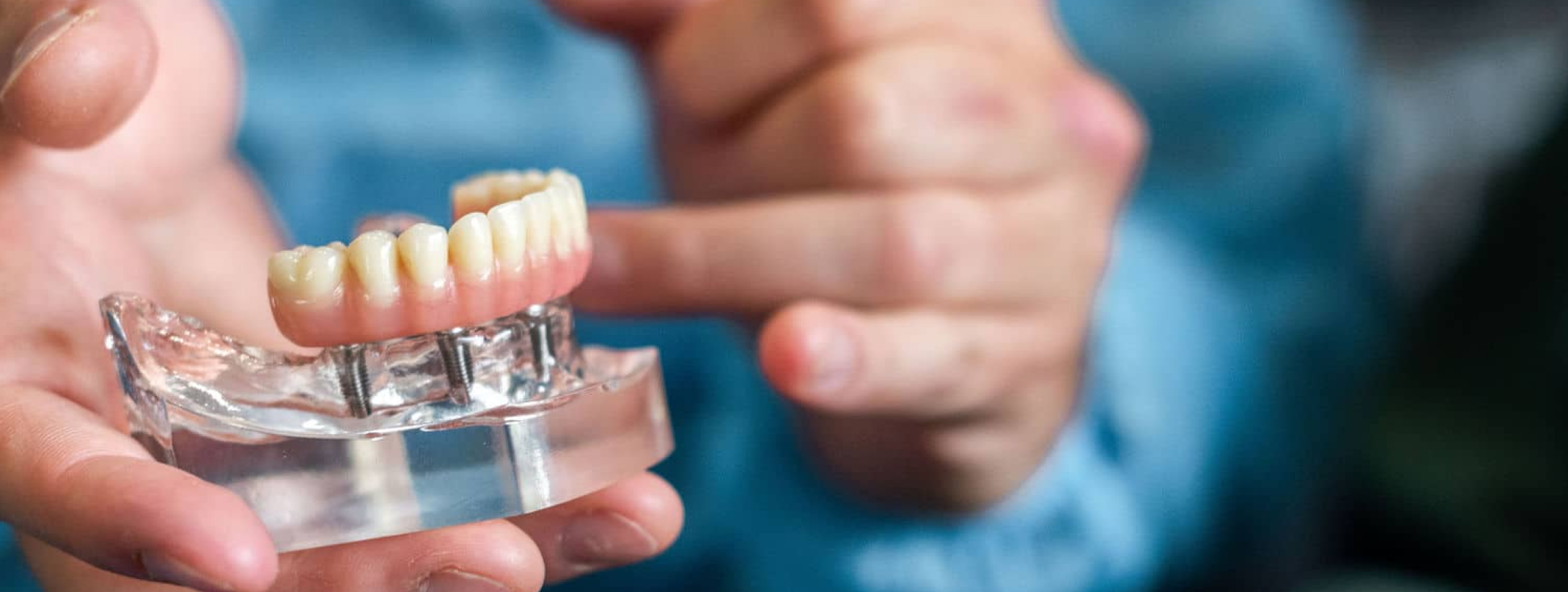 Module 4 : La prothèse implanto-portée